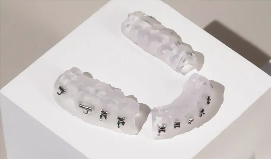 Brackets de autoligado Smile System